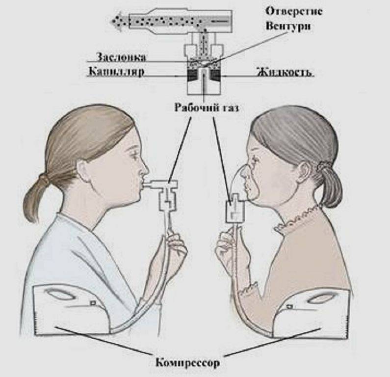 Помогает ли ингаляция. Алгоритм ингаляции через небулайзер. Техника введения лекарственных средств через небулайзер алгоритм. Схема использования ингаляции с небулайзером. Алгоритм проведения ингаляции небулайзер.