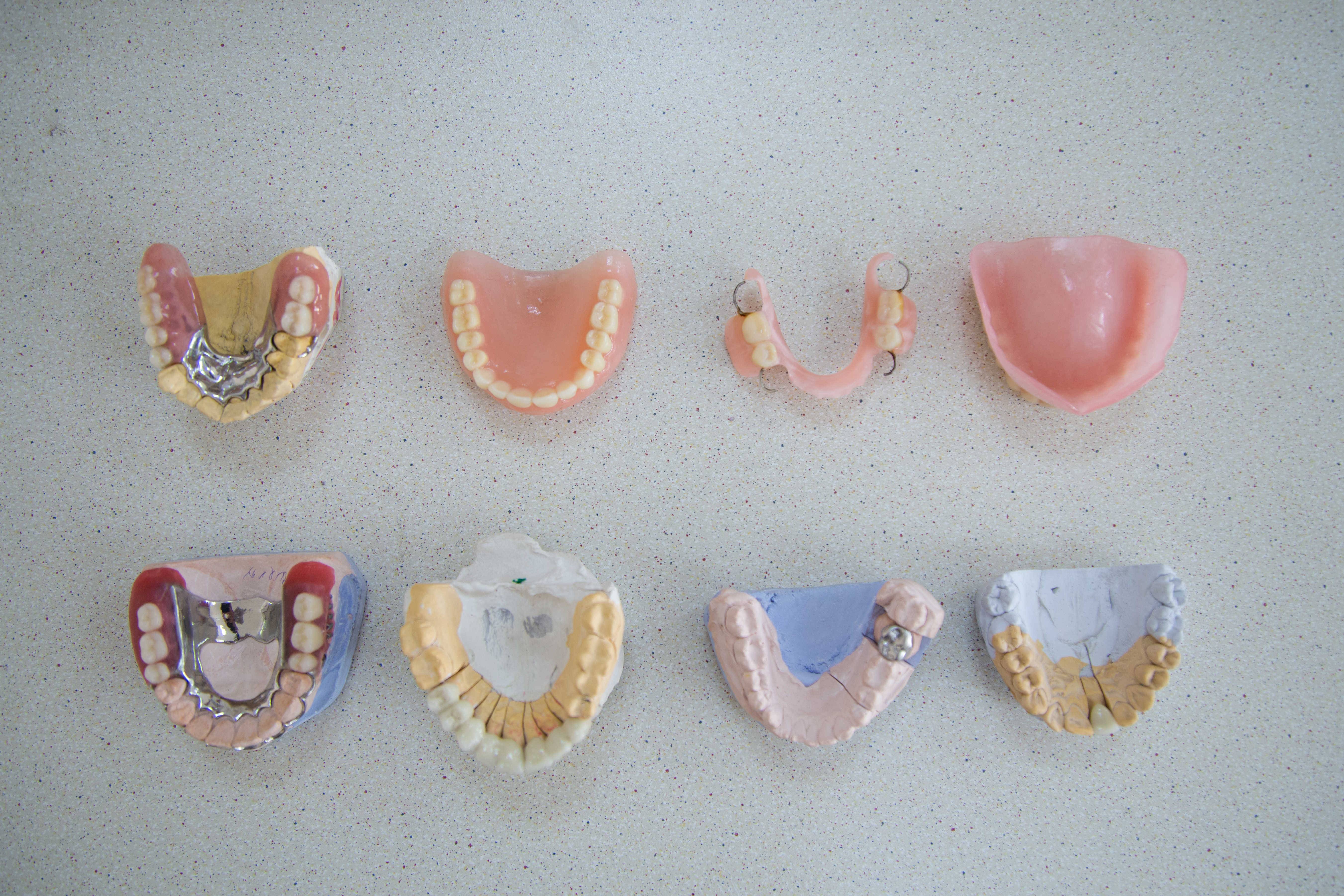 Съемные зубные протезы: фото, лучшие съемные зубные протезы, как привыкнуть