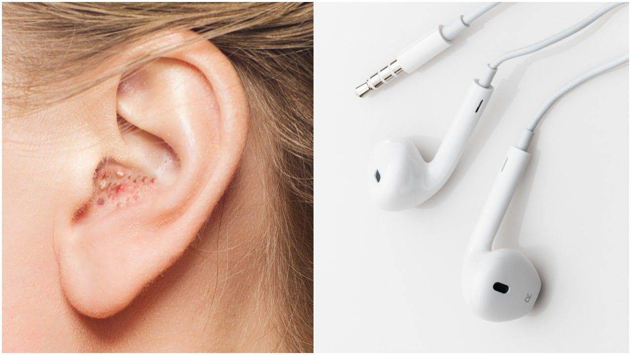 Могут ли наушники повредить слух и как это предотвратить